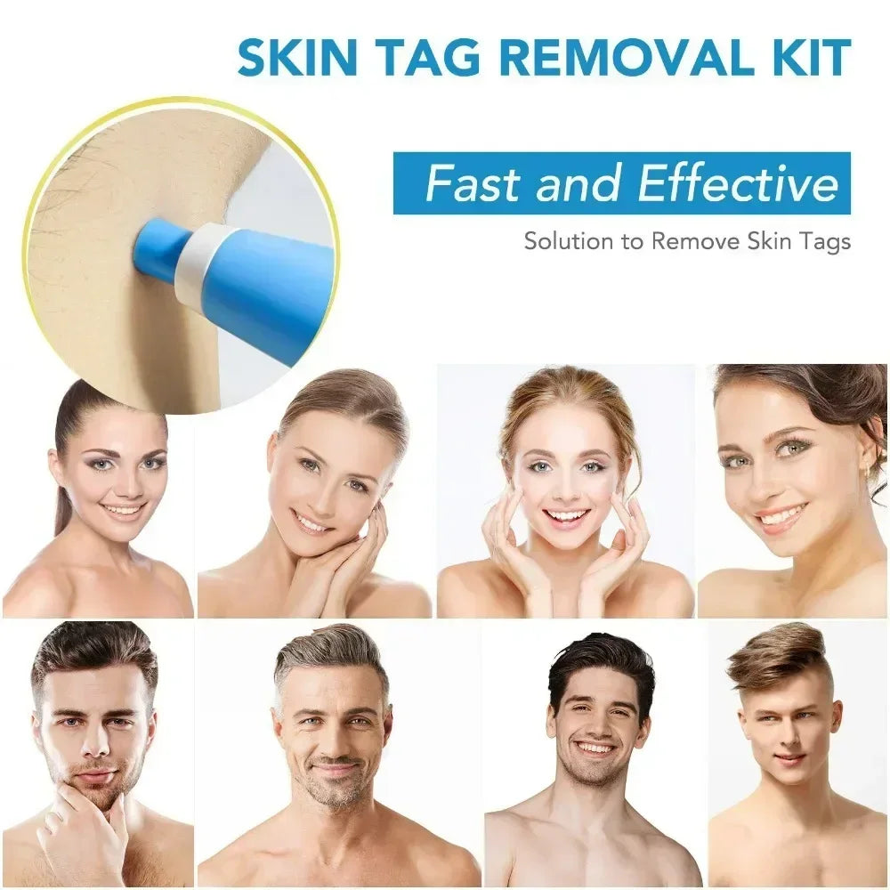 2-IN-1 Auto Skin Tag Removal Tool Kit Painless Skin Label Mole Acne Wart Removal Pen with Cleansing Swabs Facial Skin Care Tool