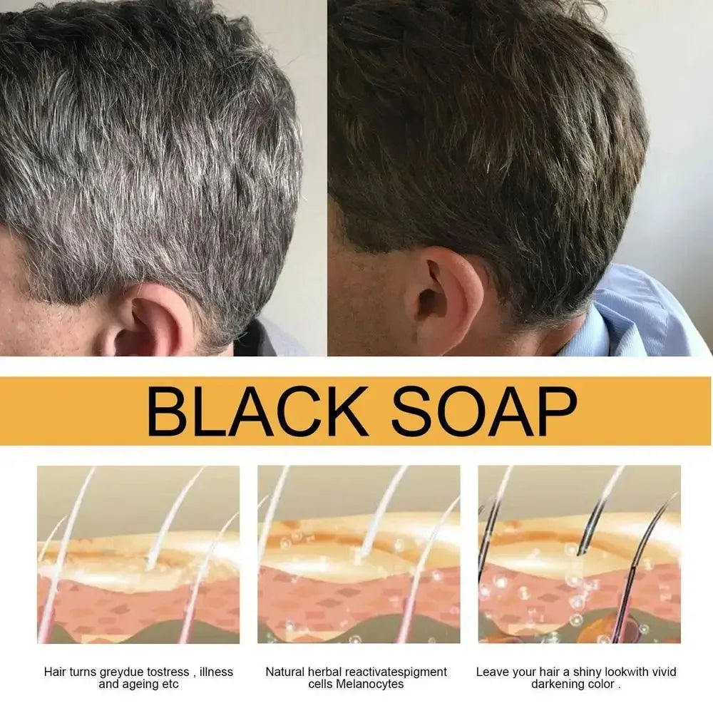 Hair Shampoo Soap Polygonum Multiflorum Black Soap White Hair Repair Soap Hair Care Set Nourishing Anti Dandruff Hair Dye Soap
